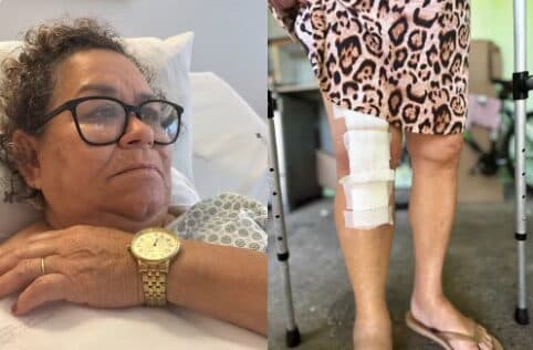 Filha de idosa que teve prótese implantada no joelho errado no PR diz que médico tentou responsabilizar paciente: ‘uma culpa que não é dela’