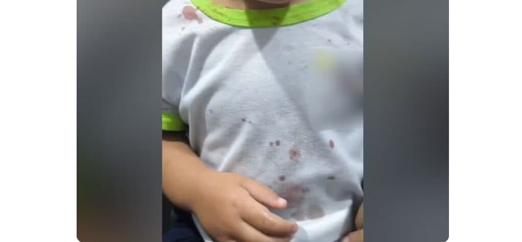 Criança chega à CMEI com ferimentos e camisa com manchas de sangue, e polícia prende padrasto por maus-tratos