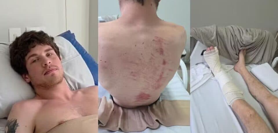 Jovem atingido por galho na Praça Osório empurrou amiga e evitou que ela também fosse atingida